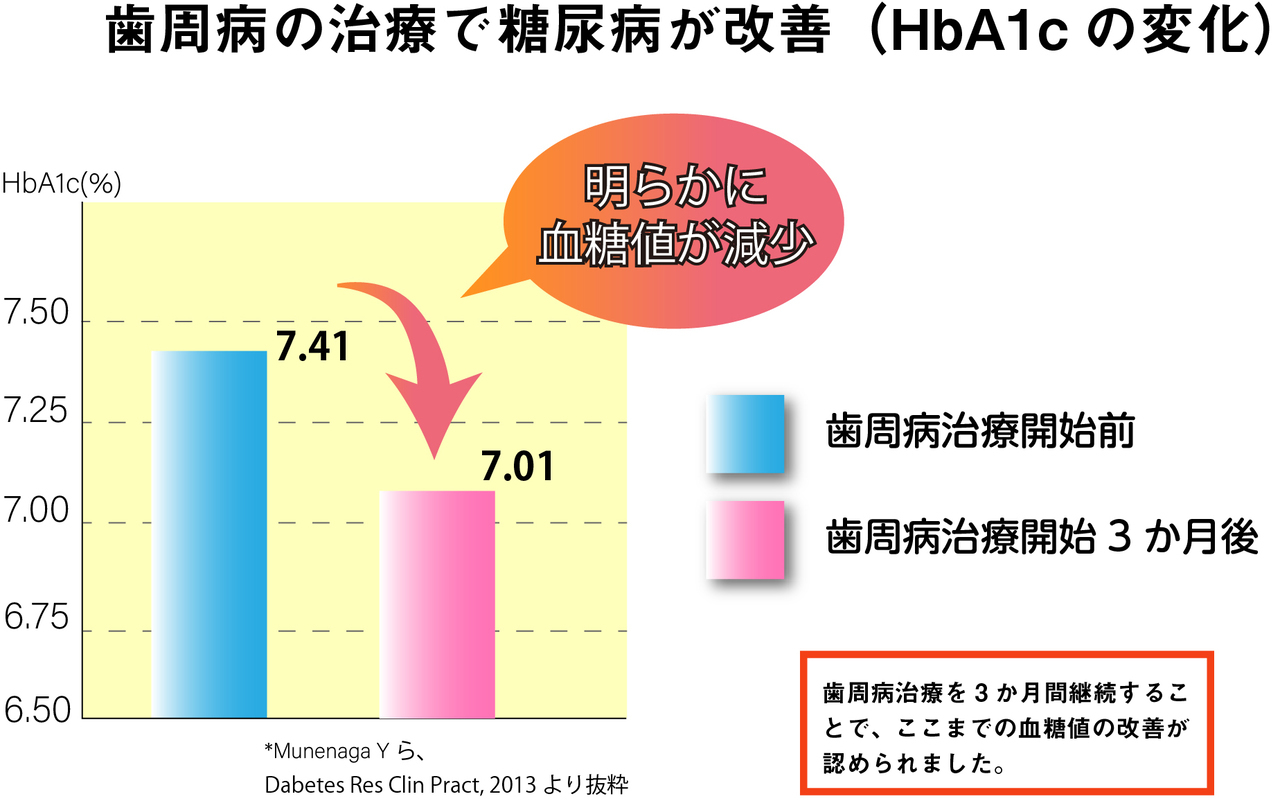 武蔵境の歯周病の進行