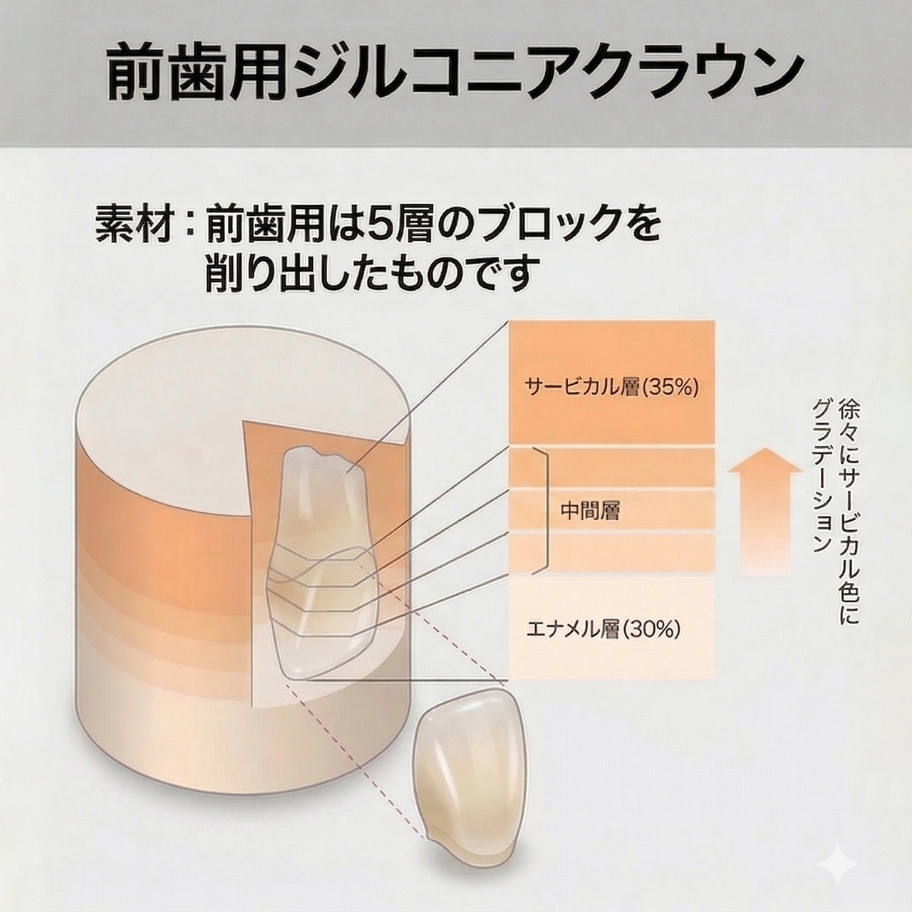 武蔵境の審美歯科(白い詰め物・被せ物)