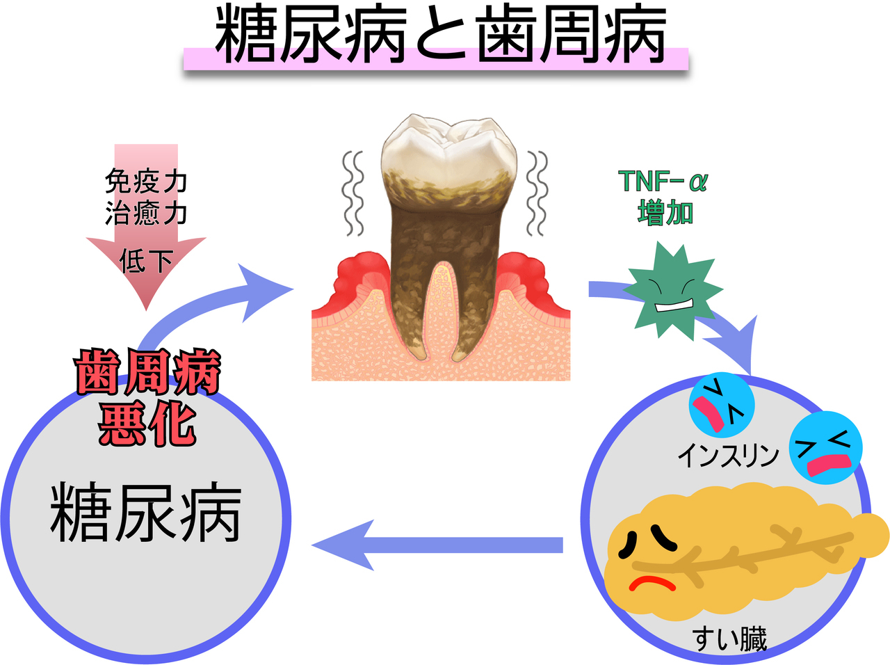 武蔵境の歯周病の進行